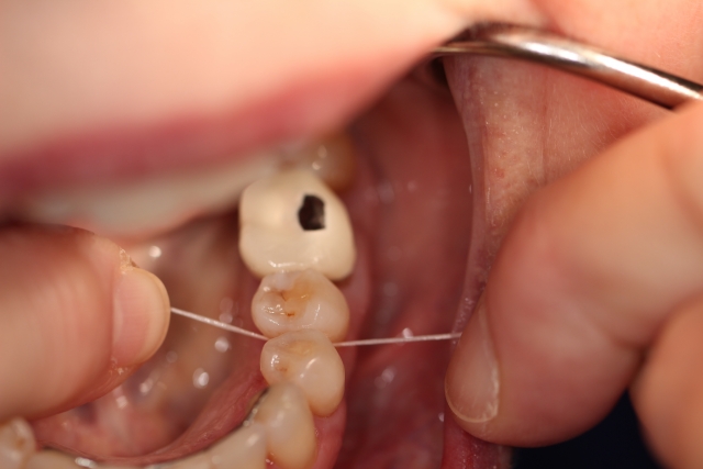 To Floss or Not To Floss: Why Is That a Question? Michael McDevitt To Floss or Not to Floss Why is That a Question Figure 1