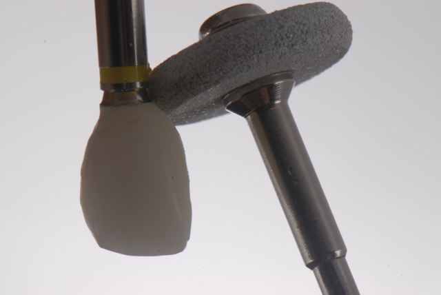 Fabrication of a Single-Tooth Implant Provisional Restoration: A Visual Essay RicardoMitrani fabrication of a single tooth implant provisional restoration Fig.10