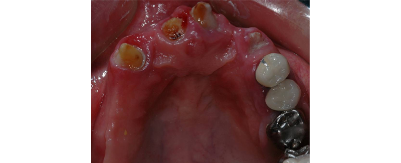 Terminal Dentition: Where Do We Draw the Line? RicardoMitrani terminal dentition where do we draw the line Fig.1