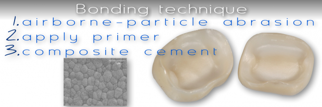 Bonding to Zirconia: Is It Possible? Robert Winter Bonding of Zirconia fig.1