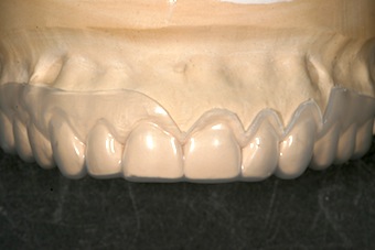 Robert Winter Fabricating Surgical Guides Featured Image