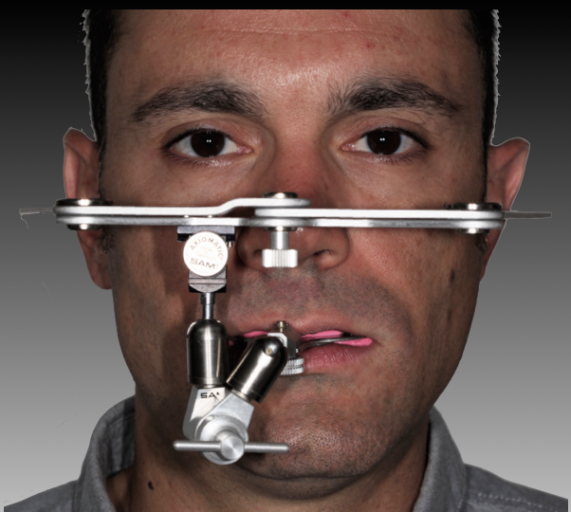 Why You Should Do a Diagnostic Wax-Up RobertWinter why you should do a diagnostic wax up Fig.2