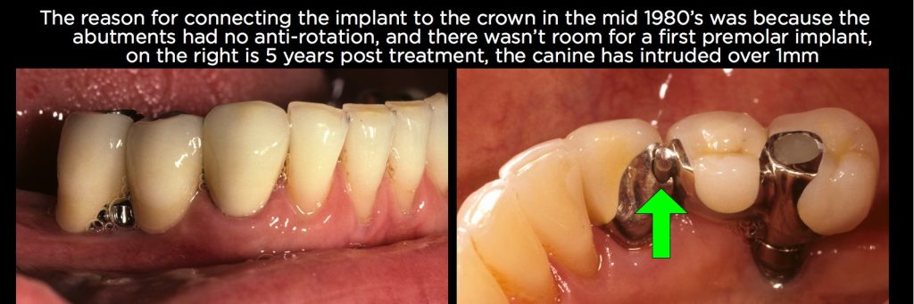 efrver Spear Connecting Figure 10