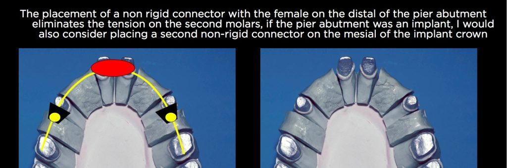 efrver Spear Connecting Figure 17