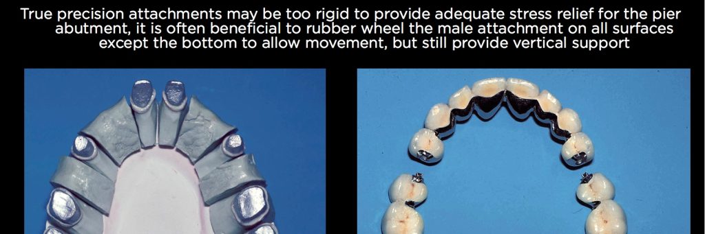 efrver Spear Connecting Figure 18