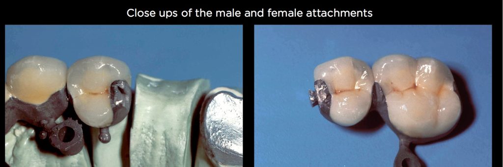 efrver Spear Connecting Figure 19