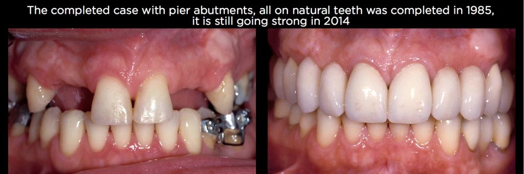 efrver Spear Connecting Figure 20
