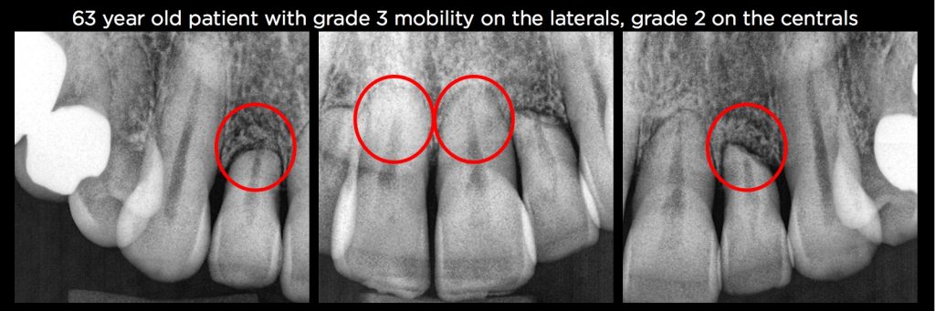 efrver Spear Connecting Figure 21