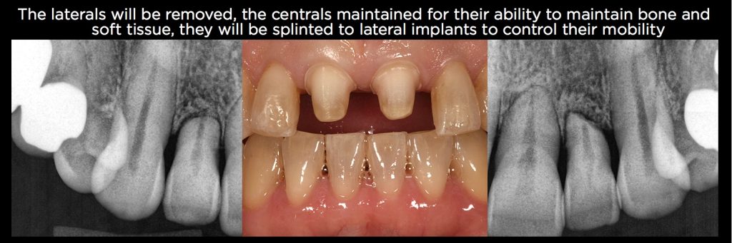 efrver Spear Connecting Figure 22