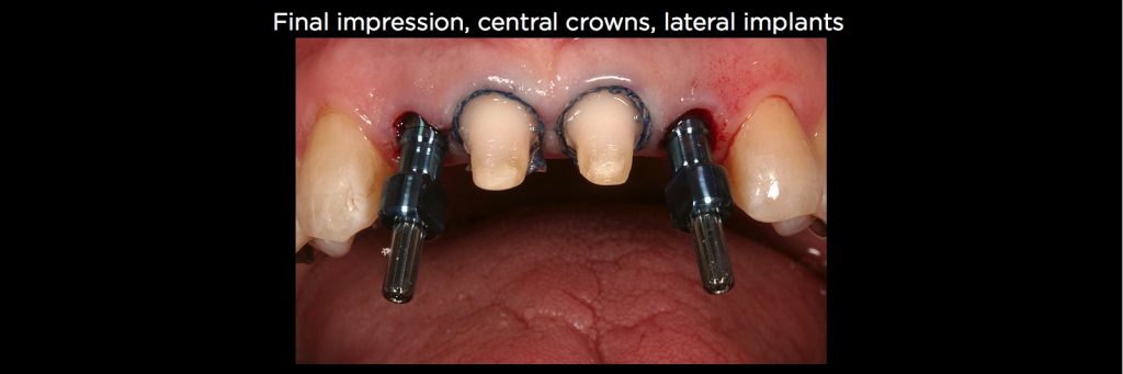 efrver Spear Connecting Figure 23