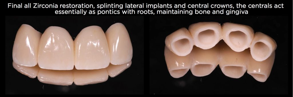 efrver Spear Connecting Figure 24