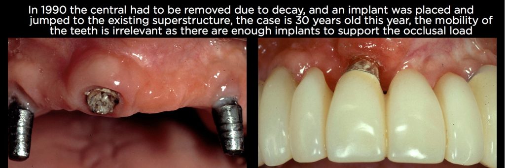 efrver Spear Connecting Figure 3