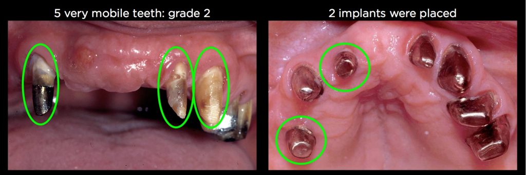 efrver Spear Connecting Figure 5