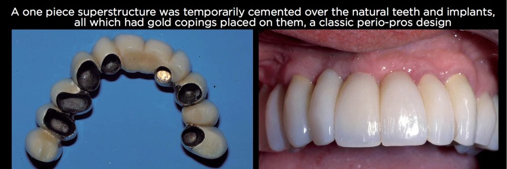 efrver Spear Connecting Figure 6