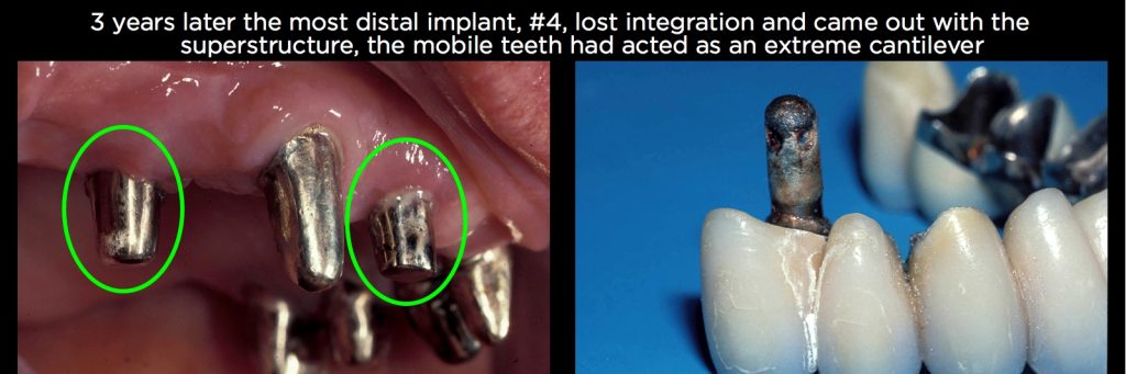 efrver Spear Connecting Figure 7