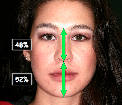 Evaluating Facial Esthetics: Vertical Proportion Spear Vertical Proportion Featured Image