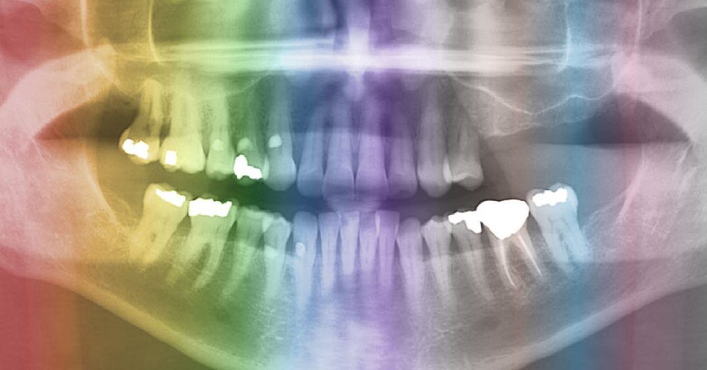 Supporting LGBTQ+ Health Equity in Dentistry SpearTeam supporting lgbtq health equity in dentistry Fig.2