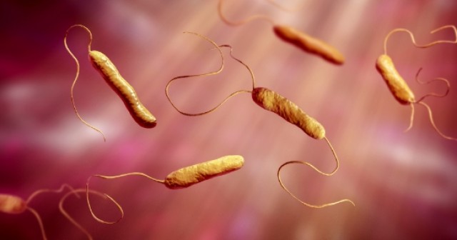 Spear Digest SpearTeam tracking and controlling the risk of endocarditis with dental procedures FeaturedImage