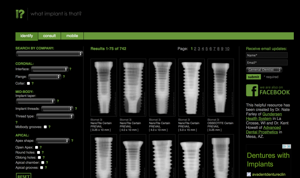 Dental Implants: What Implant is That? Steve Ratcliff Dental Implants What Implant is That Featured Image