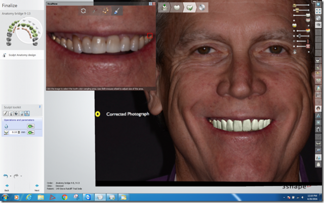 Steve Ratcliff What Digital Smile Design Did for Me Featured Image
