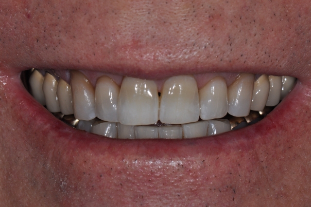 Steve Ratcliff What Digital Smile Design Did for Me Figure 1