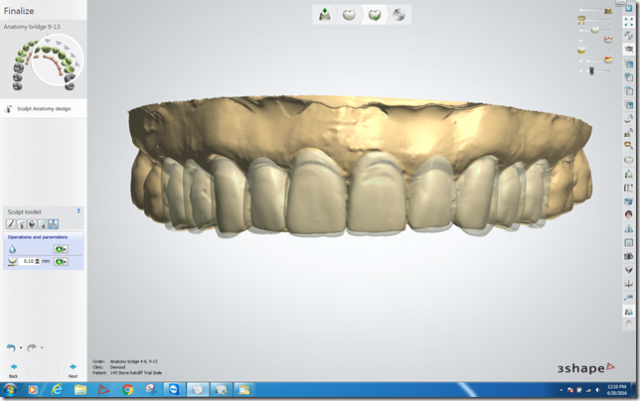 Steve Ratcliff What Digital Smile Design Did for Me Figure 3