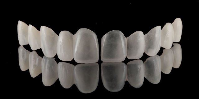 Steve Ratcliff What Digital Smile Design Did for Me Figure 4