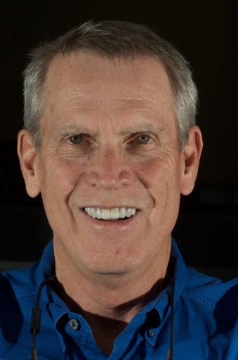 Steve Ratcliff What Digital Smile Design Did for Me Figure 5