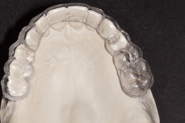 Creating a Radiographic Template for Implant Planning Step-by-Step Steve Ratcliffe Creating a Radiographic Template for Implant Planning Step by Step Figure 3