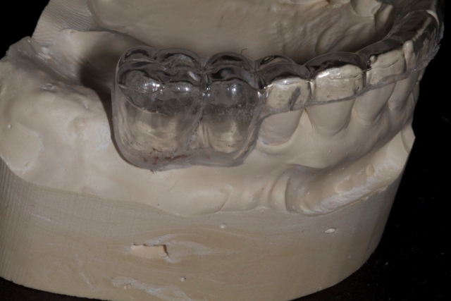Creating a Radiographic Template for Implant Planning Step-by-Step Steve Ratcliffe Creating a Radiographic Template for Implant Planning Step by Step Figure 4