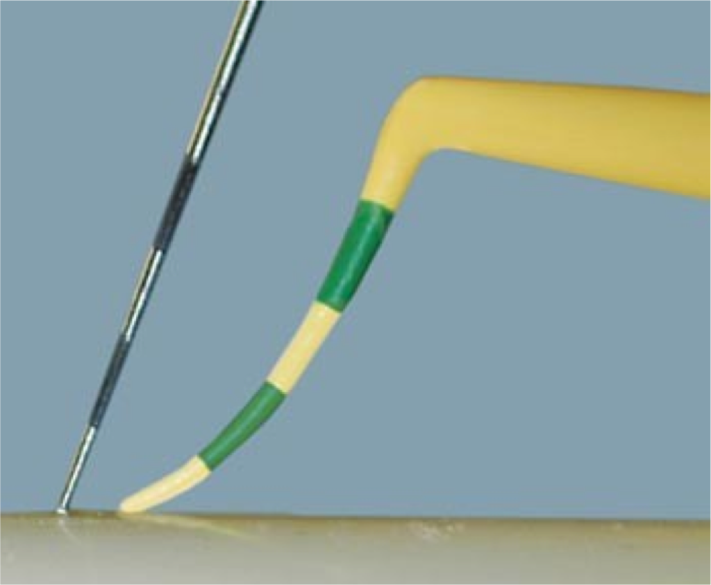 Implant Maintenance for Long-Term Success Steve Ratcliffe Implant Maintenance for Long Term Success Figure 2