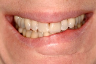 SteveRatcliff How to Evaluate a Crooked Smile Fig.1