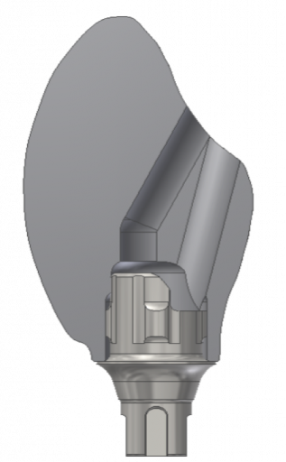Screw-Retained Restorations With Off-Angle Implants SteveRatcliff screw retained restorations with off angle implants Fig.9