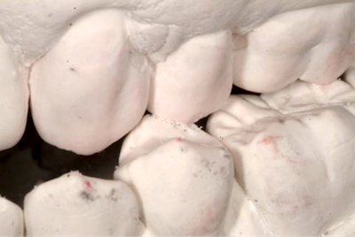 The Truth About Crossover Interferences SteveRatcliff the truth about crossover interferences Fig.1