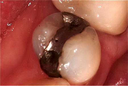 The Truth About Crossover Interferences SteveRatcliff the truth about crossover interferences Fig.2