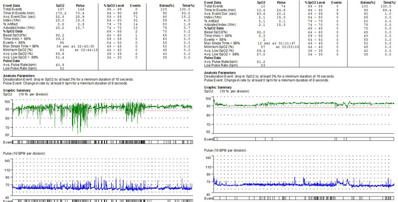 The First Step of Airway Implementation: Just Do It TJImm the first step of airway implementation just do it Fig.1
