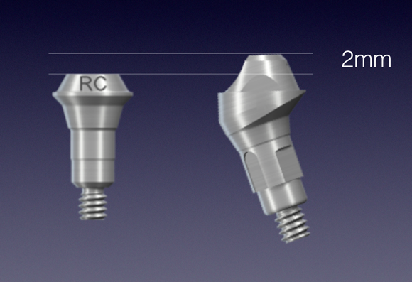 Success in Space With a Fixed Hybrid Prosthesis William Ralstin Success in Space With a Fixed Hybrid Prosthesis Figure 6