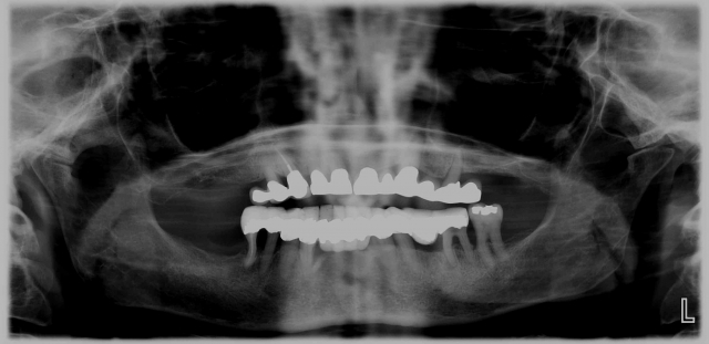 Best Practices for Presenting the Immediate Fixed Hybrid Case WilliamRalstin best practices for presenting the immediate fixed hybrid case Fig.7