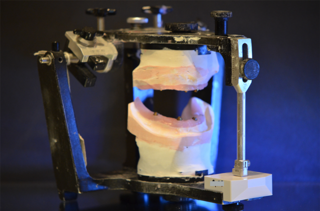 Records Necessary for Delivery of an Immediate Fixed Hybrid Case WilliamRalstin records necessary for delivery of an immediate fixed hybrid case FEaturedImage