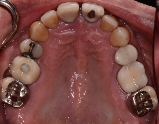 Records Necessary for Delivery of an Immediate Fixed Hybrid Case WilliamRalstin records necessary for delivery of an immediate fixed hybrid case Fig.1