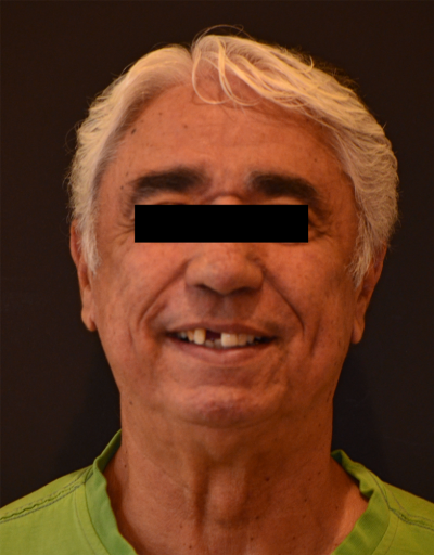 Records Necessary for Delivery of an Immediate Fixed Hybrid Case WilliamRalstin records necessary for delivery of an immediate fixed hybrid case Fig.4