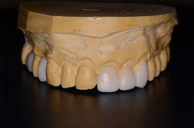 Records Necessary for Delivery of an Immediate Fixed Hybrid Case WilliamRalstin records necessary for delivery of an immediate fixed hybrid case Fig.7