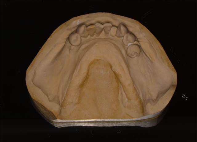 Records Necessary for Delivery of an Immediate Fixed Hybrid Case WilliamRalstin records necessary for delivery of an immediate fixed hybrid case Fig.8