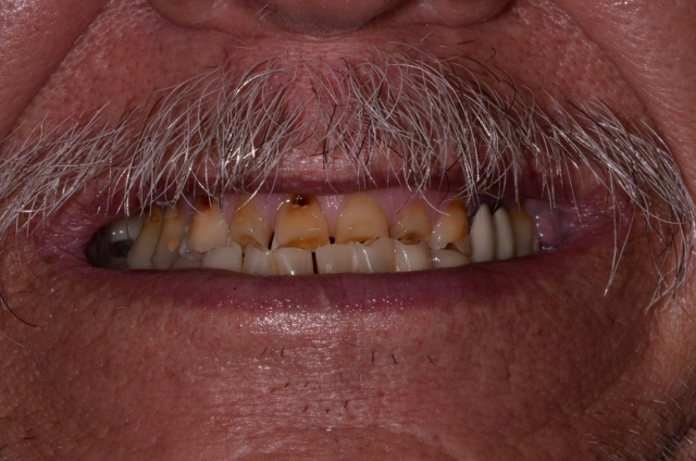 WilliamRalstin terminal dentition 6 common causes Fig.1