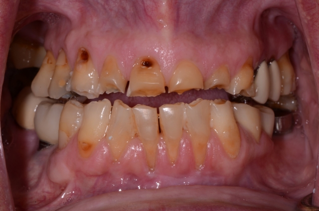 WilliamRalstin terminal dentition 6 common causes Fig.3