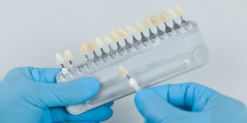 Winter cost of laboratory remakes 01