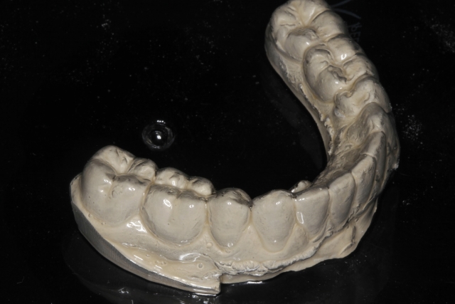 CourtneyLavigne a conservative effective approach to white spot lesions Fig.4