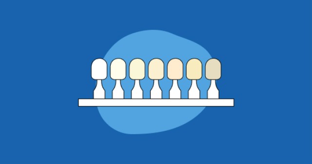 A Guide to Better Shade-Taking in Dentistry
