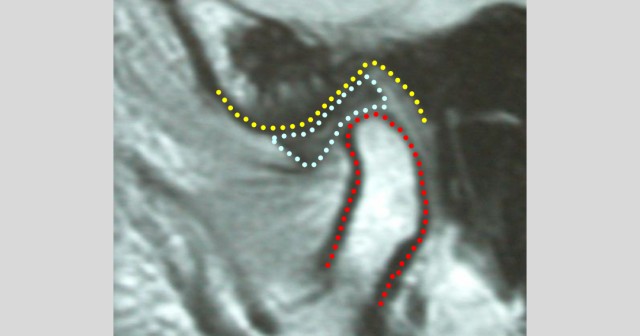 What Is Centric Relation?