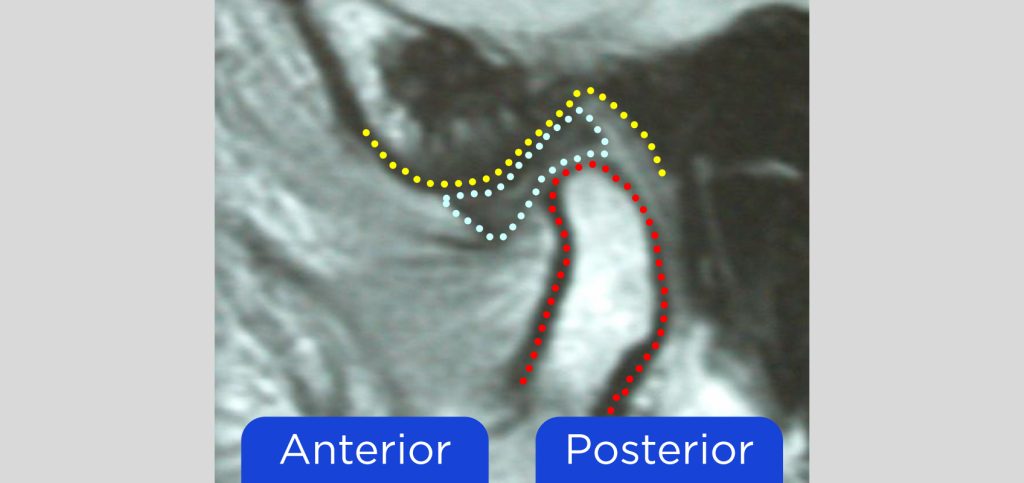 What Is Centric Relation? Jim McKee What Is Centric Relation Figure 1
